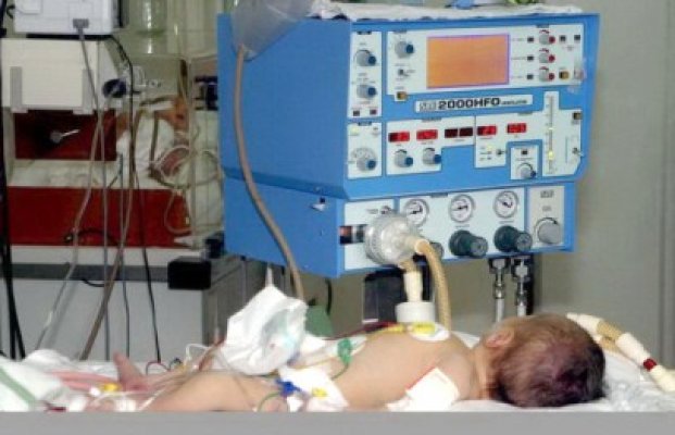 Bebeluş, decedat din cauza cirozei hepatice